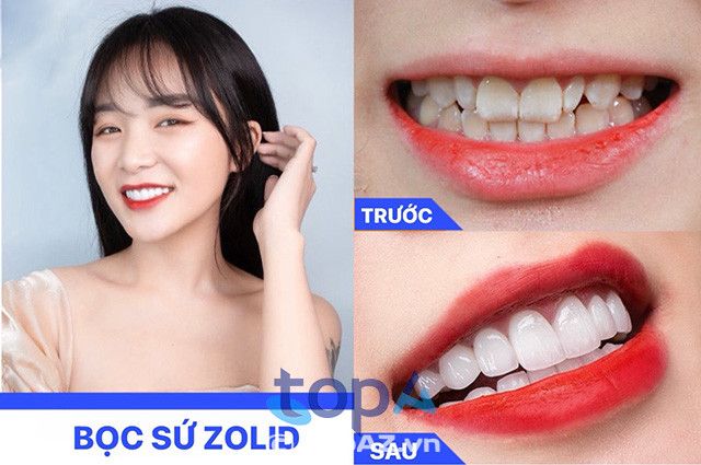 Nha khoa Đà Lạt - Đẳng cấp nha khoa thẩm mỹ chuẩn quốc tế