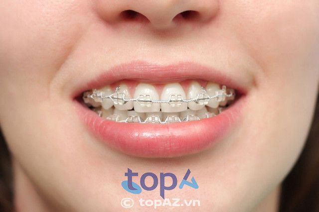 Nha Khoa Mỹ An 2 - Địa chỉ vàng về niềng răng tại Nha Trang