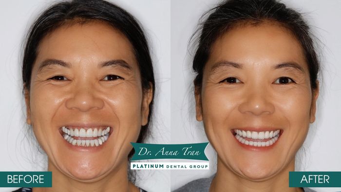 Hệ thống trang thiết bị tân tiến tại Platinum Dental Group