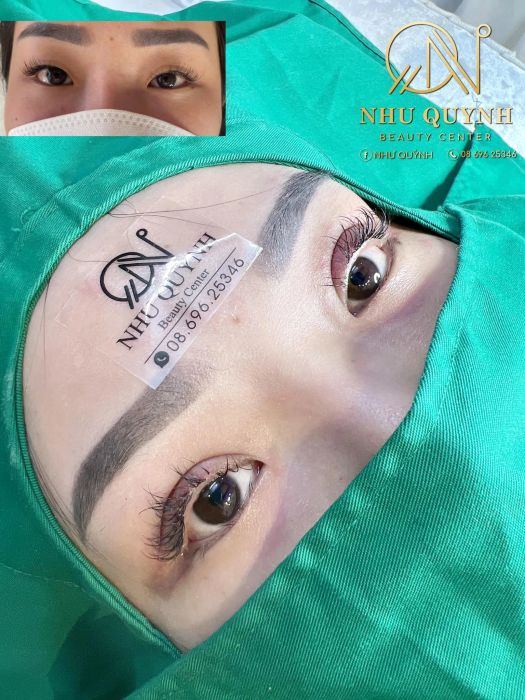 Hình ảnh thực tế về quy trình thẩm mỹ tại Như Quỳnh Beauty Center