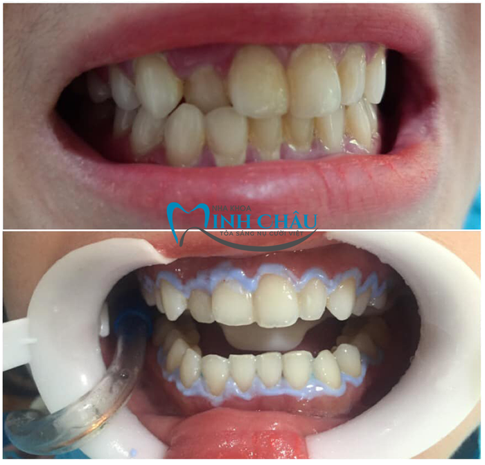 Hình ảnh 2 – Không gian hiện đại tại Nha Khoa Minh Châu