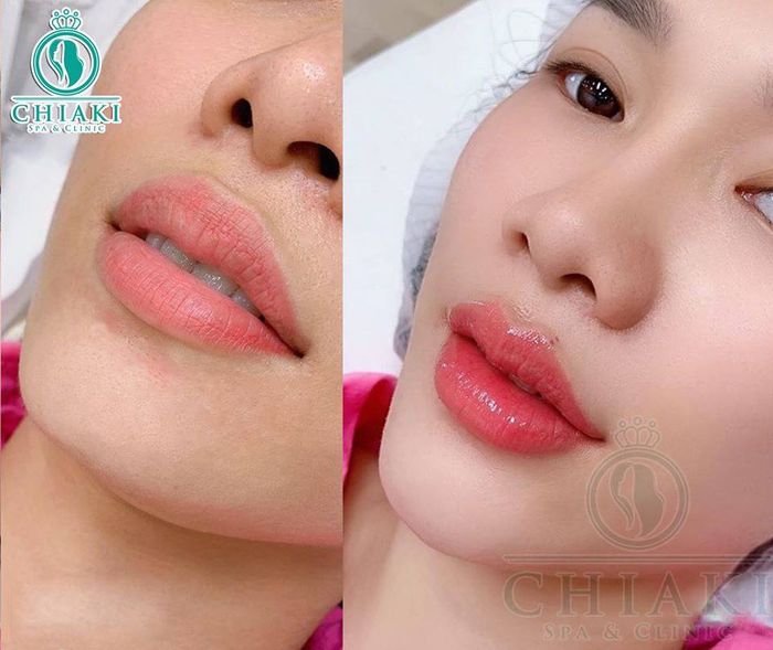 Viện Thẩm Mỹ ChiaKi - Ảnh 2