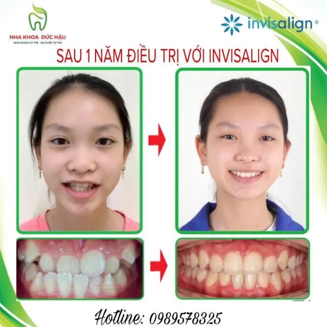 Phòng khám nha khoa chất lượng tại TP. Thái Bình