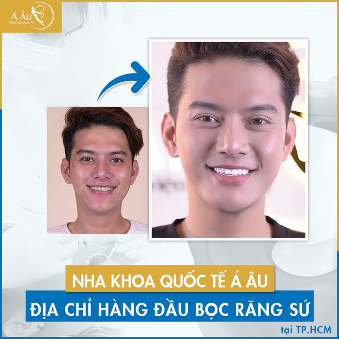 Hình ảnh thực tế Nha Khoa Quốc Tế Á Âu