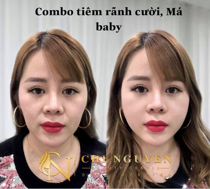 Chi Nguyen Beauty Center - Ảnh 1