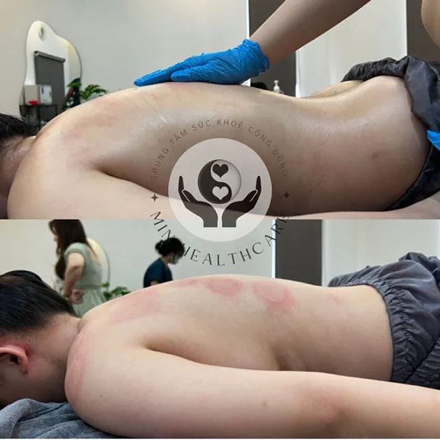 Địa chỉ vàng trong làng trị liệu cổ vai gáy tại Thủ Đức