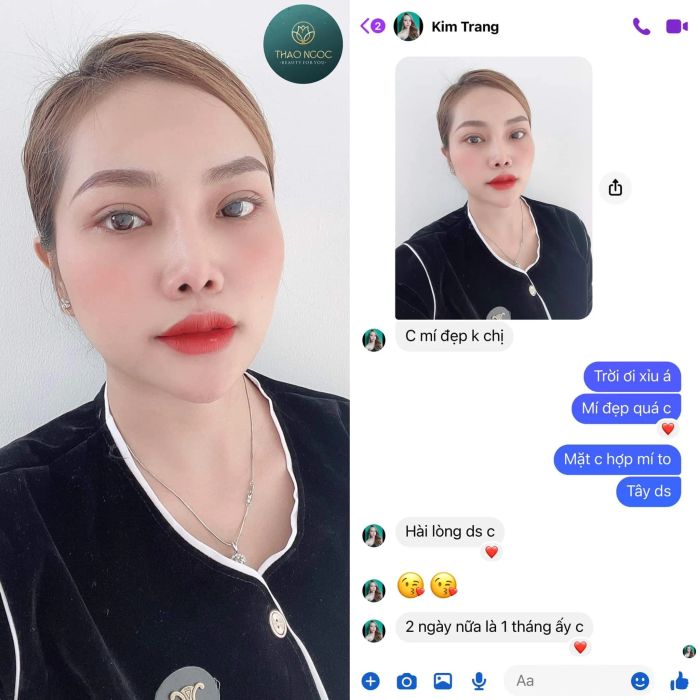Hình ảnh thực tế quy trình thẩm mỹ tại Thảo Ngọc Beauty
