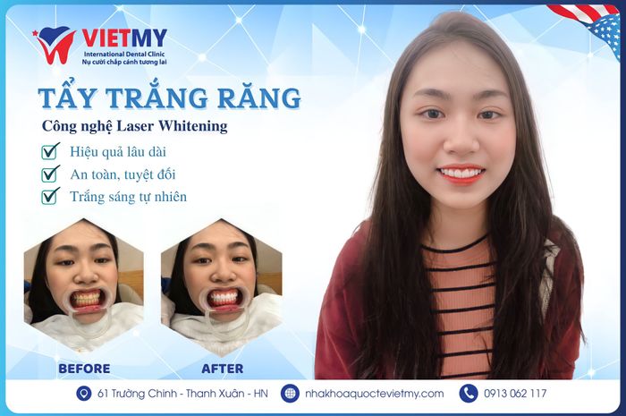 Hình ảnh 1 – Nha Khoa Quốc Tế Việt Mỹ - Bác Sĩ Lê Thiên Quế