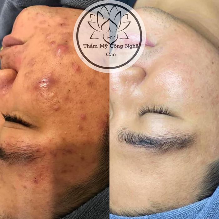 Không gian sang trọng và hiện đại tại Thẩm Mỹ HT