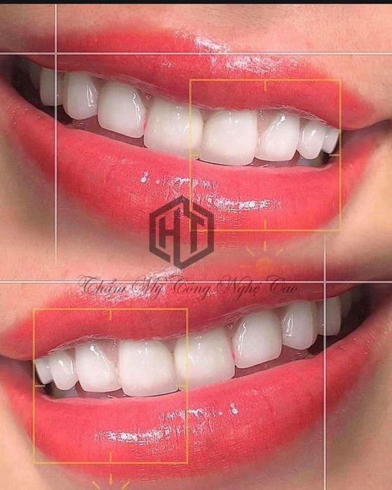 Hình ảnh khu vực điều trị chuyên nghiệp tại Thẩm Mỹ HT