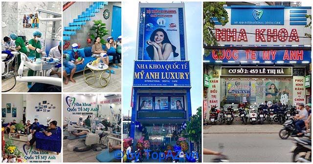 Nha khoa Quốc tế Mỹ Anh - Địa chỉ vàng chăm sóc răng miệng tại Hóc Môn
