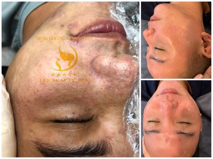 Khu vực điều trị chuyên nghiệp với trang thiết bị hiện đại tại Lee Beauty Spa