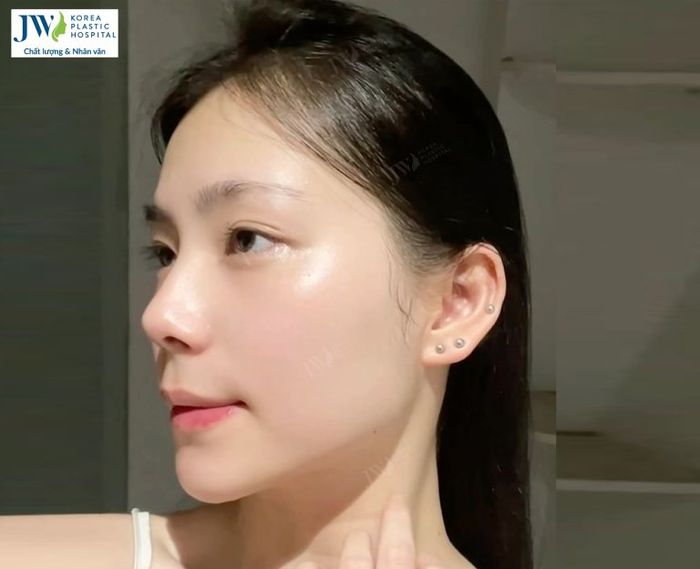 Bệnh viện thẩm mỹ JW ảnh 2