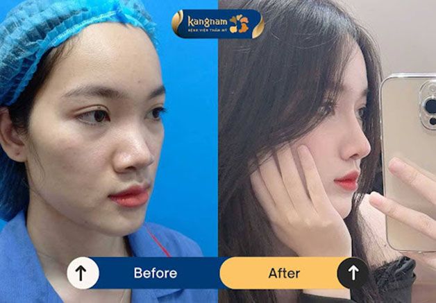 Bệnh viện thẩm mỹ Kangnam ảnh 1