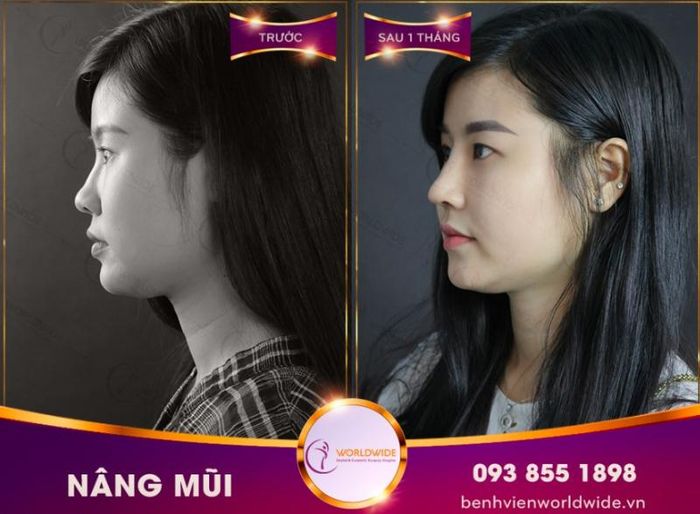 Bệnh viện thẩm mỹ Worldwide ảnh 1