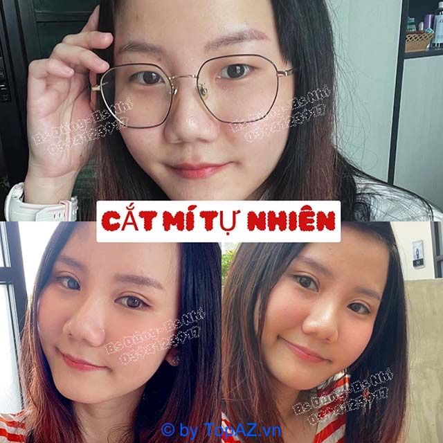 Dịch vụ làm đẹp tại Phòng khám Nàng Thơ
