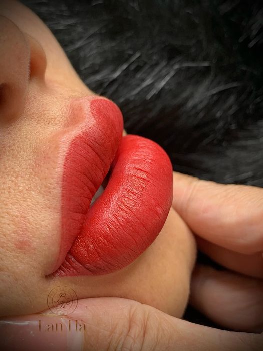 Bộ sưu tập hình ảnh khách hàng trước và sau khi phun môi