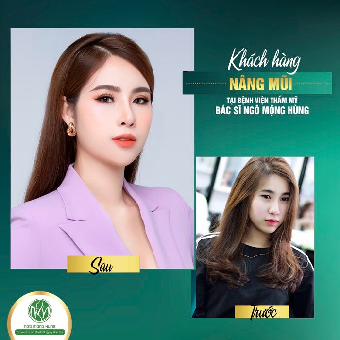 Bệnh Viện Thẩm Mỹ Ngô Mộng Hùng ảnh 2