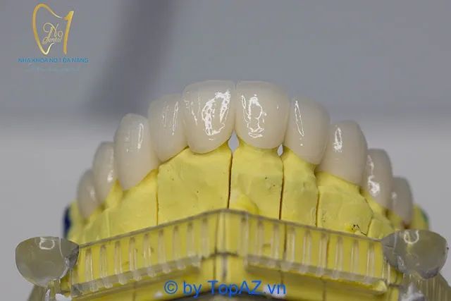 Dịch vụ làm răng sứ