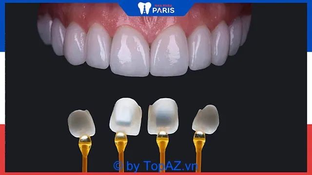 Dịch vụ làm răng chất lượng tại Đà Nẵng