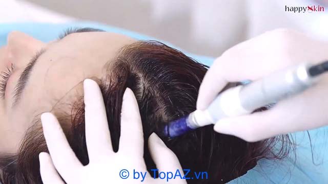 Trải nghiệm liệu trình trị rụng tóc chuẩn y khoa tại Happy Skin Medical TP.HCM