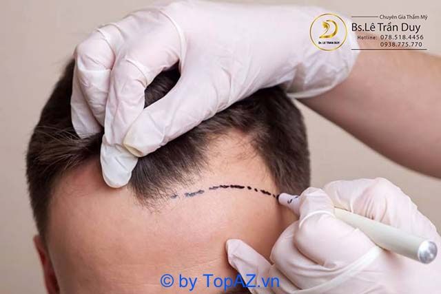 Khám phá các phòng khám trị rụng tóc uy tín và chất lượng tại TP.HCM
