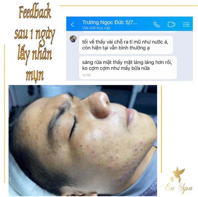 Én Spa (Trị mụn tại Quận 9, TPHCM)