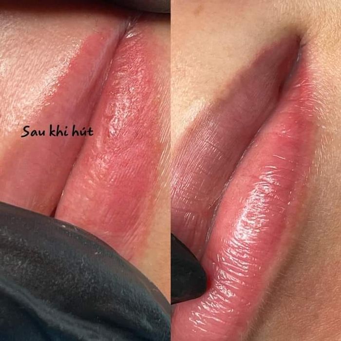 Phòng điều trị hiện đại tại Spa Như Ý (ảnh 2)