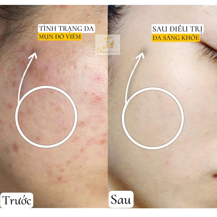 Không gian trị liệu sang trọng tại Diris Beauty & Spa