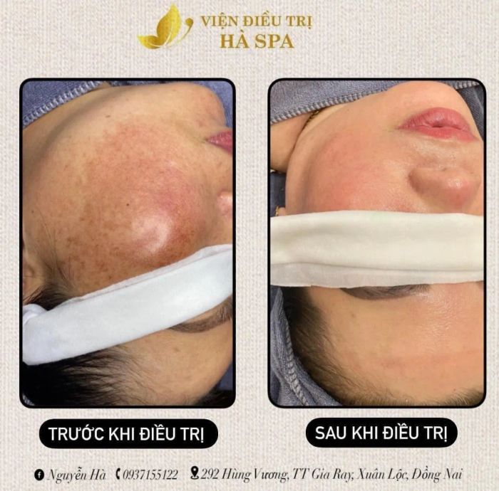Hà Spa - Hình ảnh 1