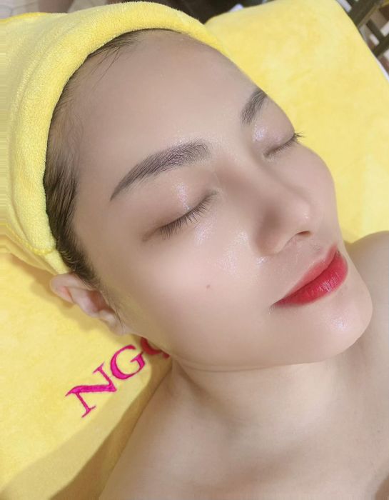 Quy trình điều trị chuyên nghiệp tại Thẩm Mỹ Viện Ngọc Hường - Ảnh 2