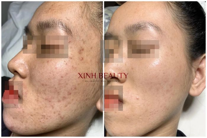 Xinh Beauty - Hình ảnh 2