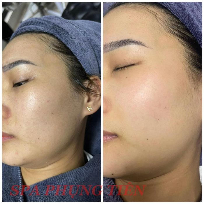 Quy trình chăm sóc da chuyên nghiệp tại PHỤNG TIÊN Spa