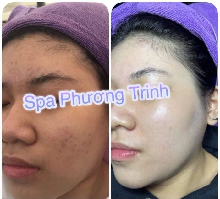 Hình ảnh Spa Phương Trinh 1