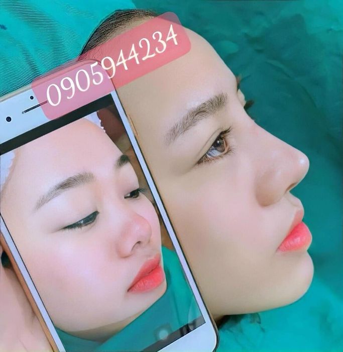 Quy trình thẩm mỹ chuyên nghiệp tại Anna Spa & Clinic - Ảnh 2