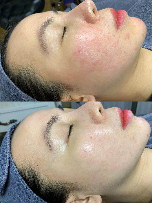 Trải nghiệm dịch vụ cao cấp tại Mialala Beauty Center - Ảnh 2