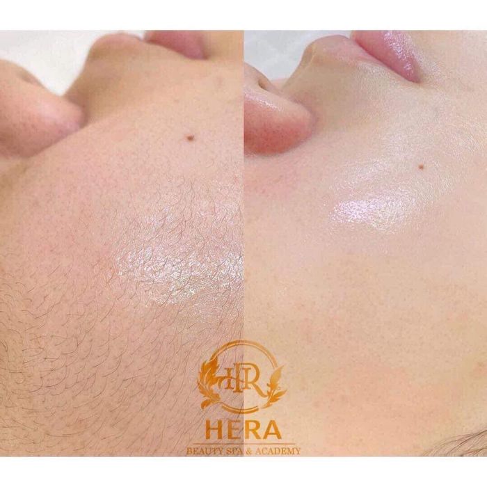 Viện thẩm mỹ Hera - Bộ sưu tập hình ảnh thực tế sống động về không gian và dịch vụ đẳng cấp