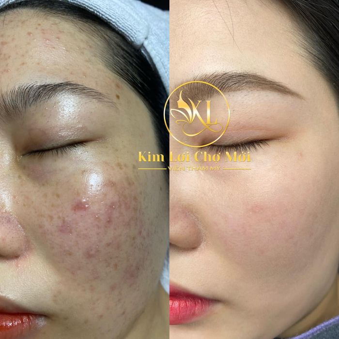 Phòng trị liệu cao cấp tại Spa Kim Lợi (ảnh 2)