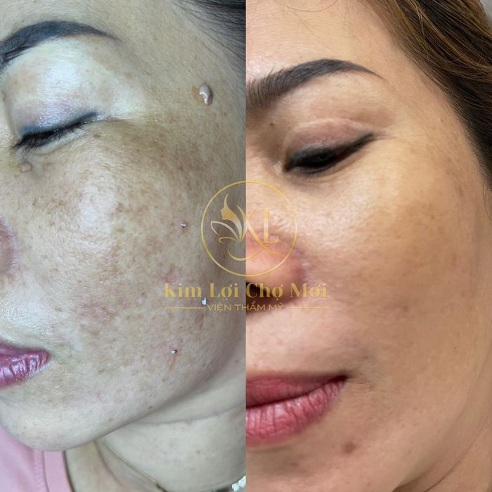 Không gian thư giãn tại Spa Kim Lợi (ảnh 1)