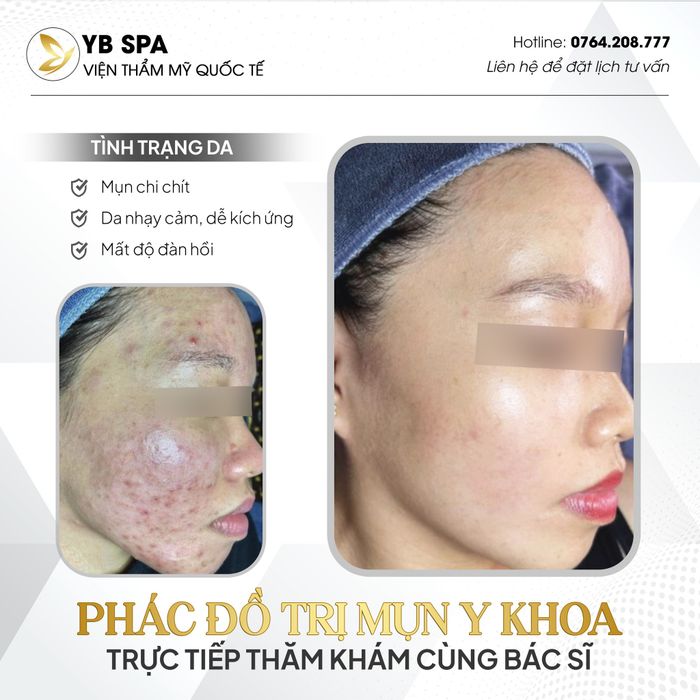 YB Luxury Spa & Clinic & Academy ảnh 2