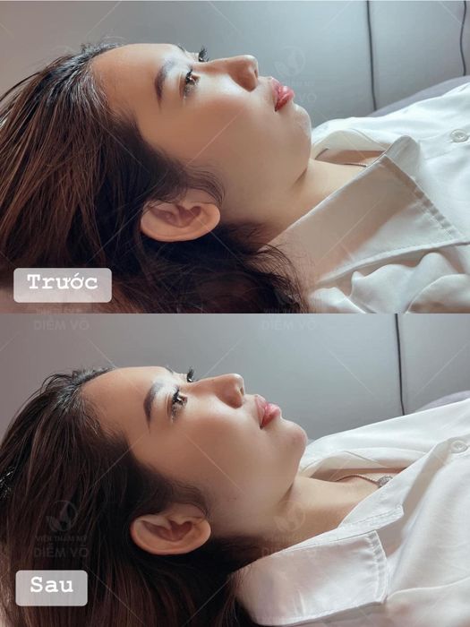 Hình ảnh thực tế về quy trình chăm sóc da chuyên nghiệp tại Viện Thẩm Mỹ Diễm Võ