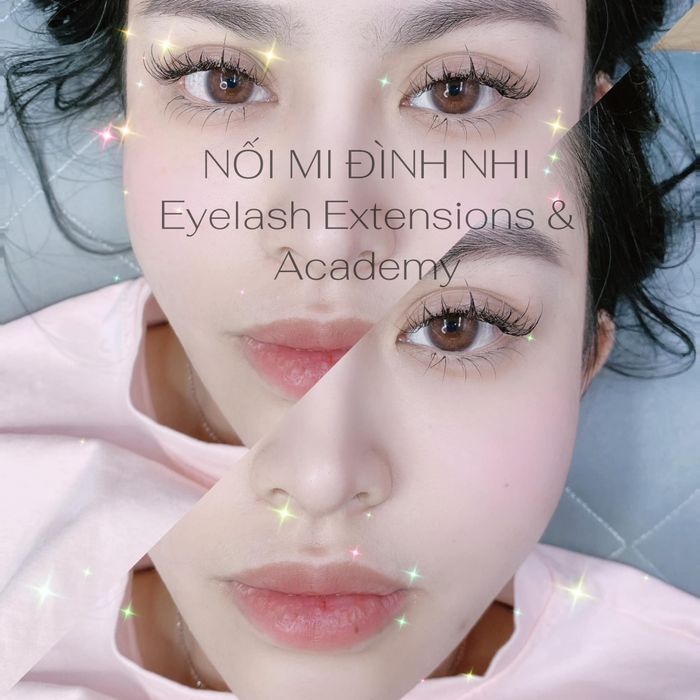 NỐI MI ĐÌNH NHI - Hình ảnh 1