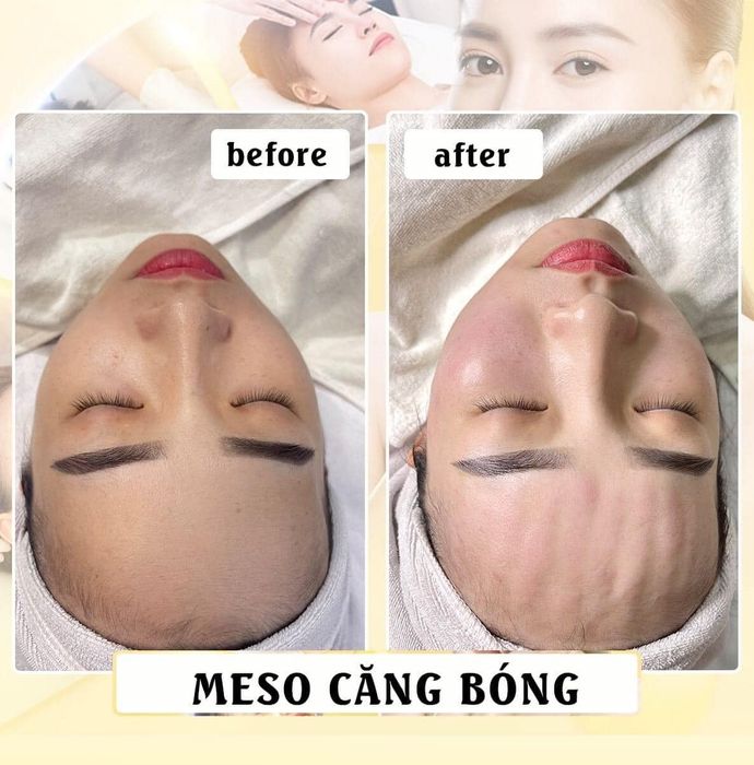 Thu Hường Spa ảnh 2 - Hình ảnh phòng điều trị tiêu chuẩn 5 sao với hệ thống máy móc tân tiến nhất.