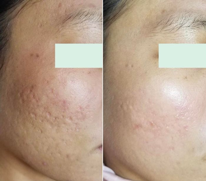 Hình ảnh Spa Loan Nguyễn – Không gian trị liệu ấm cúng và chuyên nghiệp