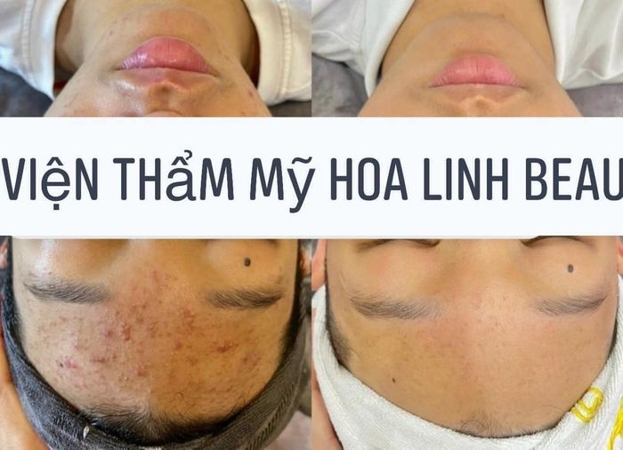 Viện Thẩm Mỹ Hoa Linh Beauty ảnh 1 - Không gian sang trọng với thiết kế hiện đại, chuẩn phong cách Hàn Quốc