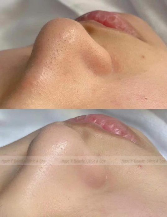 Hình ảnh Ngọc Ý Beauty, Clinic & Spa – Không gian chăm sóc sắc đẹp tinh tế