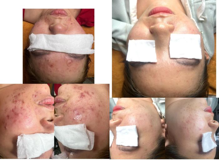 Hình ảnh quy trình làm đẹp chuyên nghiệp tại Ngọc Minh Beauty Spa