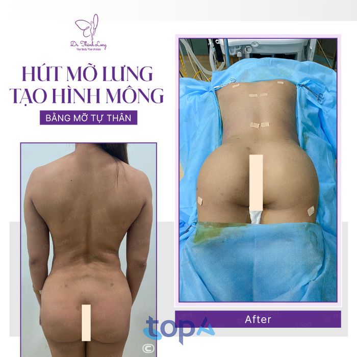 Bác sĩ CKI Trương Thành Long tại TPHCM