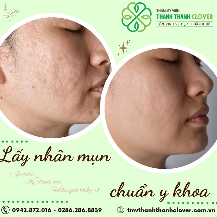 Hình ảnh thực tế về không gian hiện đại tại Thẩm Mỹ Viện Thanh Thanh Clover
