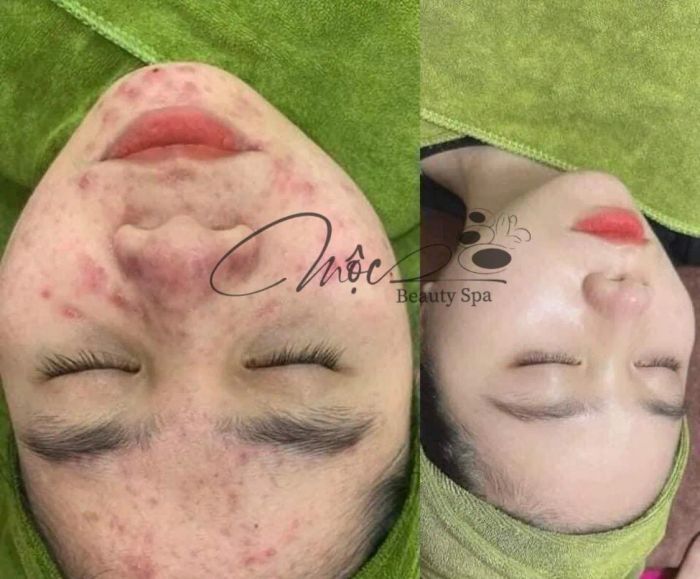 Không gian ấm cúng và chuyên nghiệp tại Mộc Beauty & Spa
